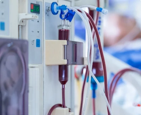Dialysis machine tubing and equipment in clinic | Associated Nephrology Consultants | Maplewood MN